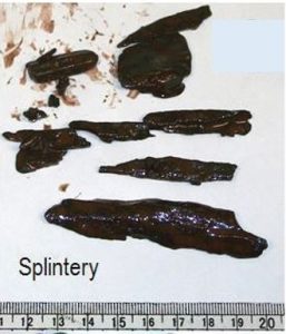 Splintery cavings